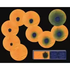 Тест-система для инвазивной экспресс-диагностики Helicobacter pylori по уреазной активности №100